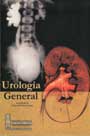Urología general